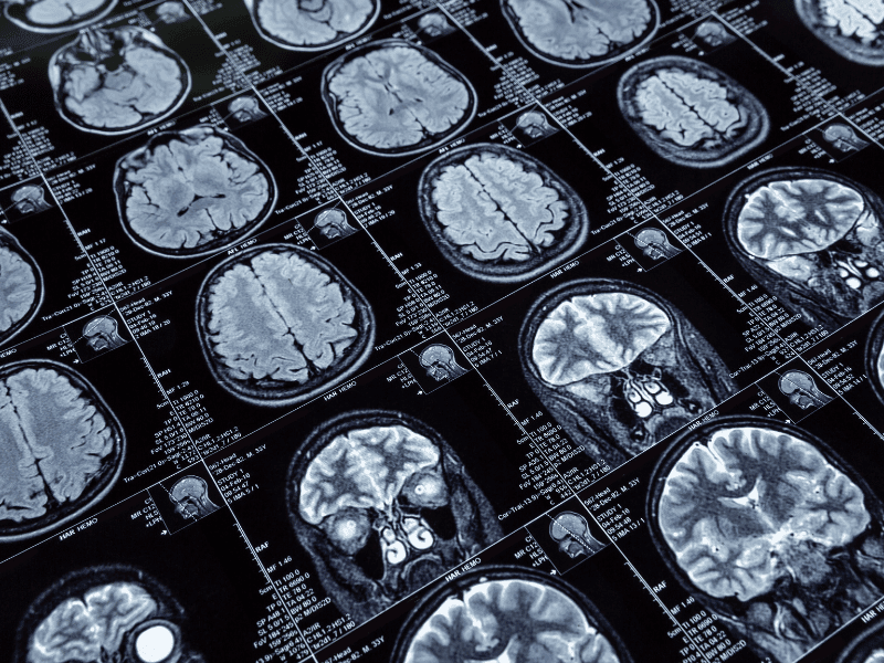 Departamento de Neurociencias