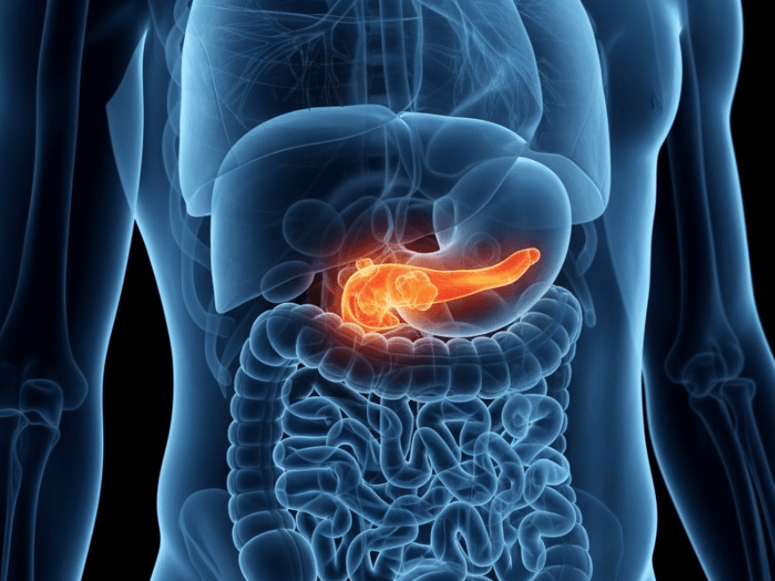 Nuevos desafíos metabólicos: hipertrigliceridemia severa, MASLD y lípidos