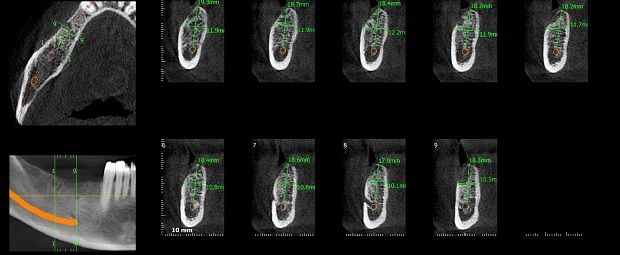 Diagnóstico por Imágenes Odontológicas