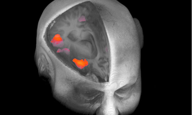 El cerebro en pleno funcionamiento: Resonancia Magnética Funcional