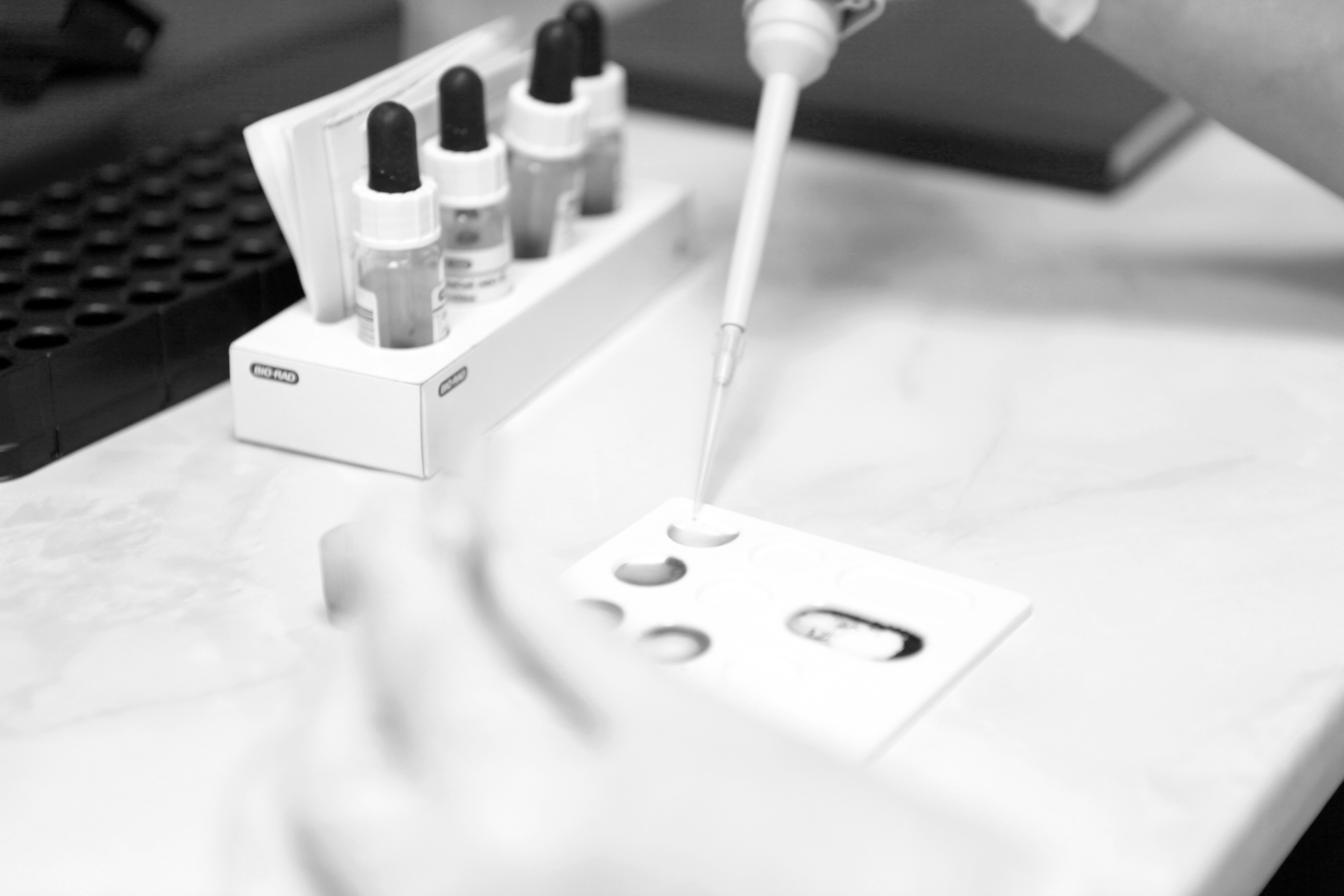 Trombosis: ¿Se puede evaluar el riesgo de desarrollarla?