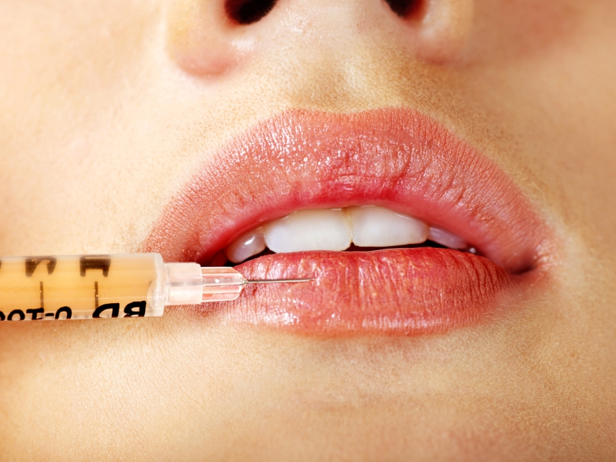 Cirugía de Labios: Perfilado, modelado y aumento