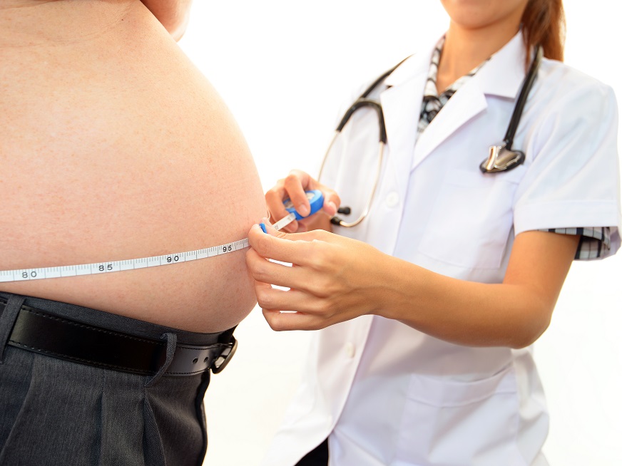 Obesidad y Cáncer Colorrectal