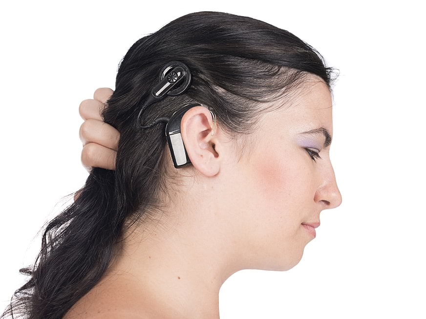 Implante Coclear: "Oír" nuevamente