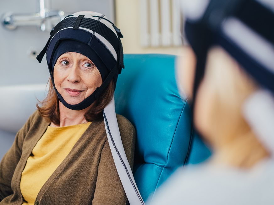 Enfriamiento capilar: prevención de alopecia durante el tratamiento de quimioterapia