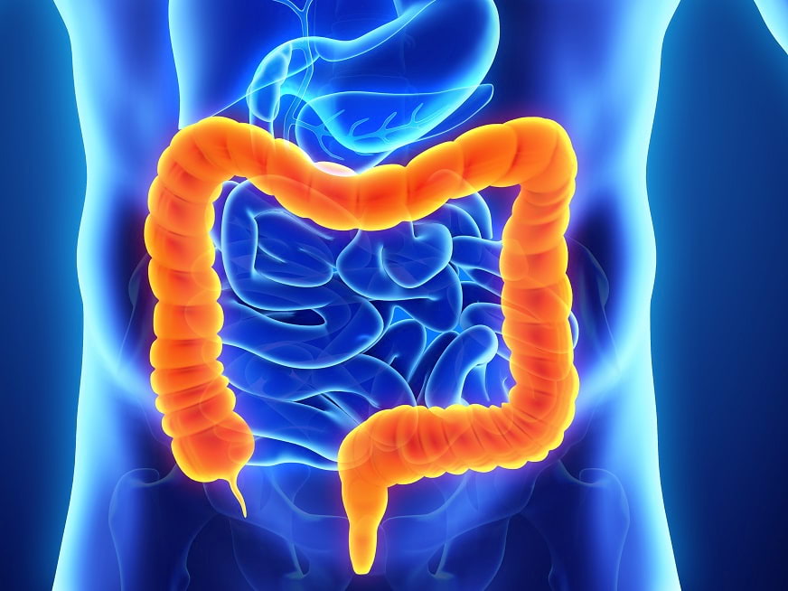Avances en cirugía del cáncer de recto
