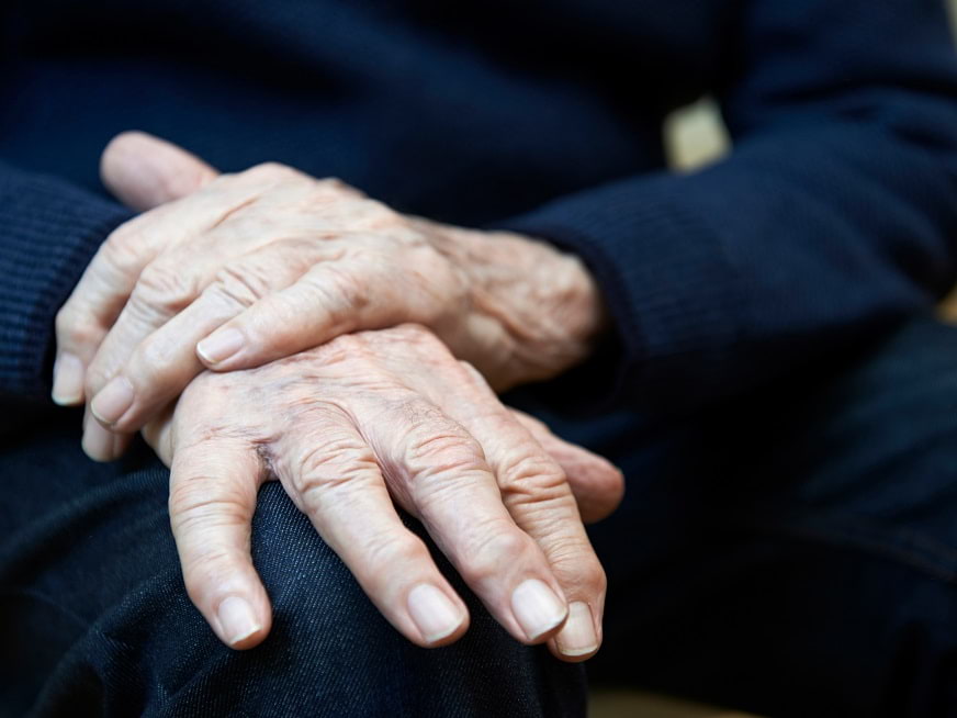 ¿Qué es el Parkinson?