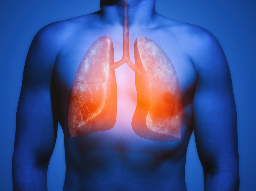 Ateneo Semanal - Cardiología