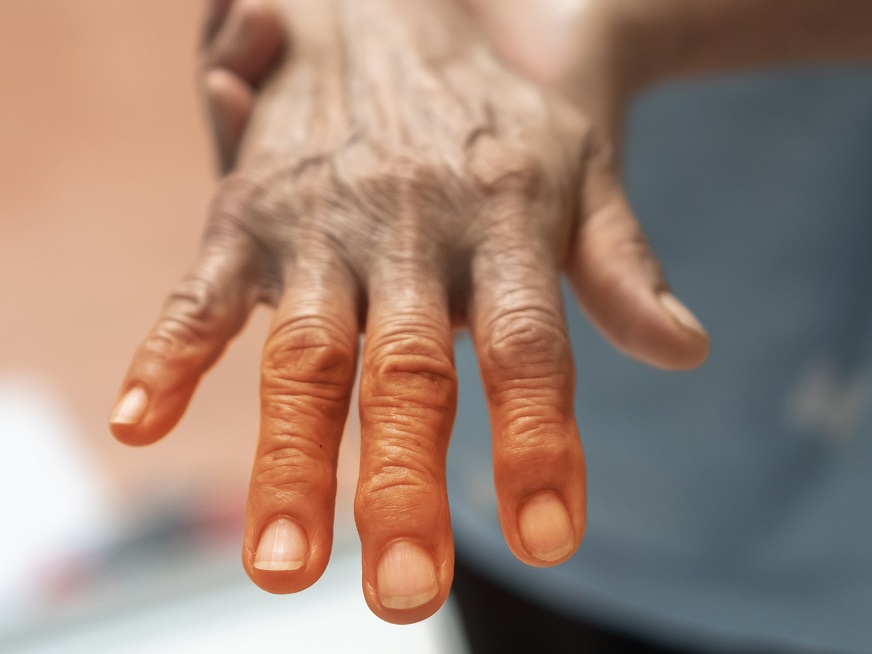 Día mundial del Parkinson