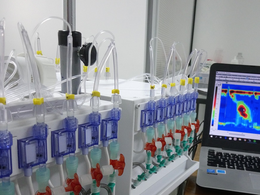 Manometría esofágica de alta resolución