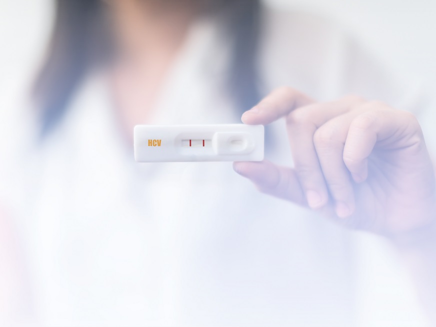 Hepatitis C: la importancia del test