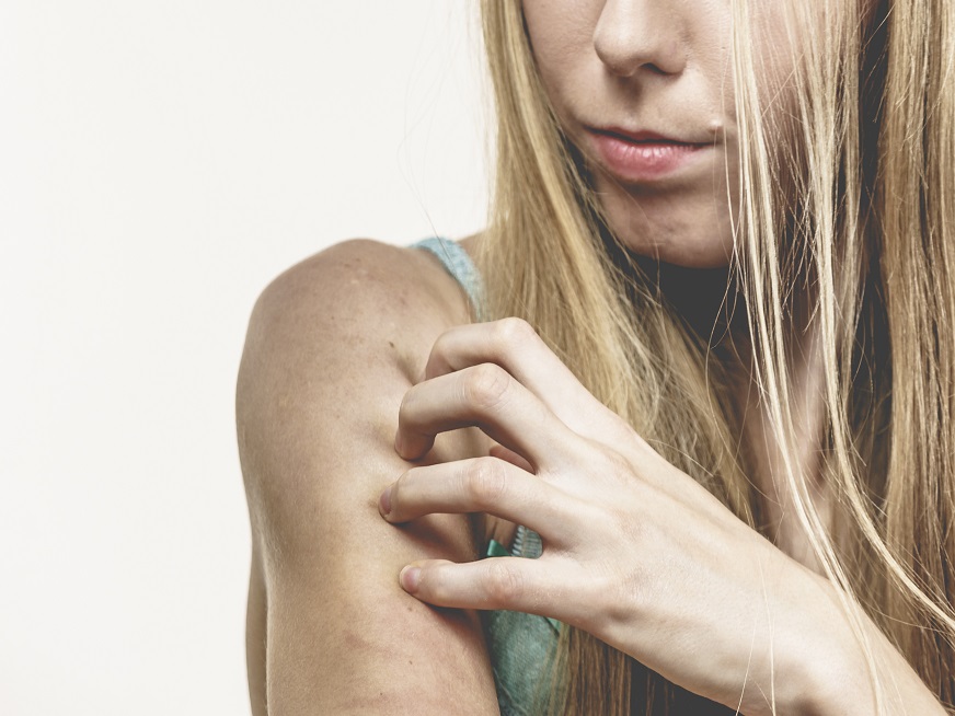 Dermatitis: diferentes tratamientos para cada grado