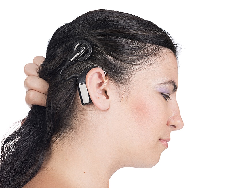 25 de febrero: Día Internacional del Implante Coclear