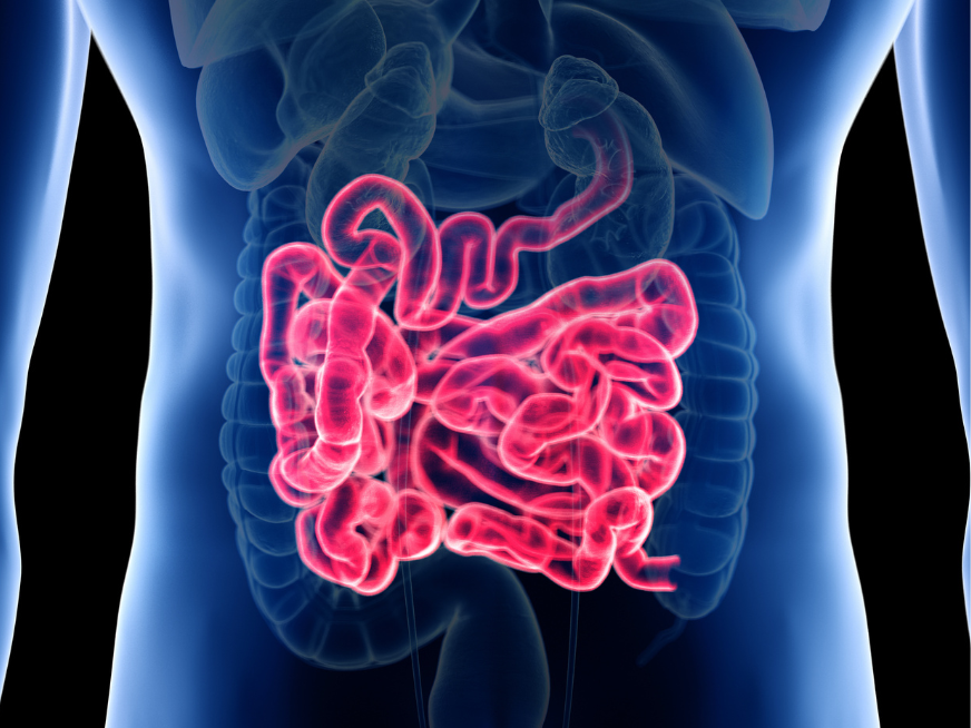 Enfermedad intestinal inflamatoria ¿De qué se trata?
