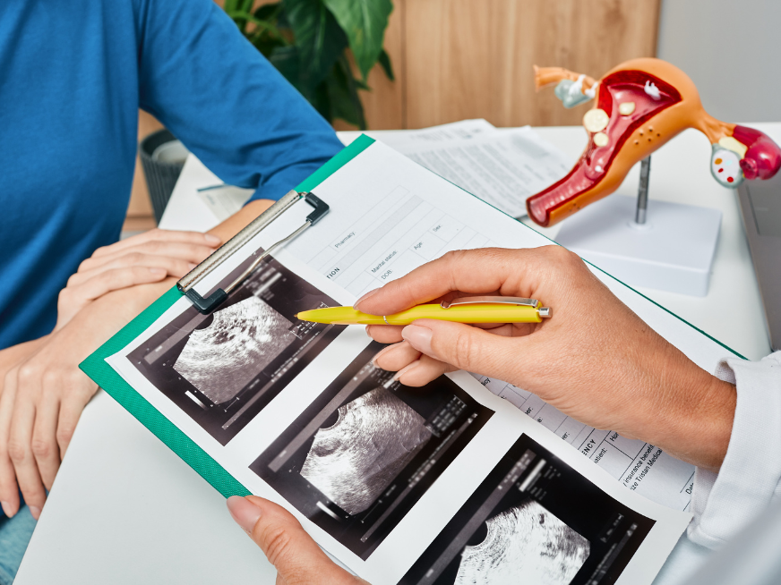 Métodos anticonceptivos reversibles de larga acción:  DIU de cobre, DIU hormonal, Implante hormonal.