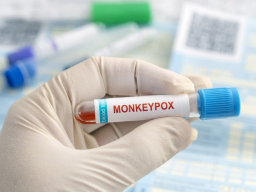 Viruela Símica (MPOX) ¿De qué se trata la viruela del mono?