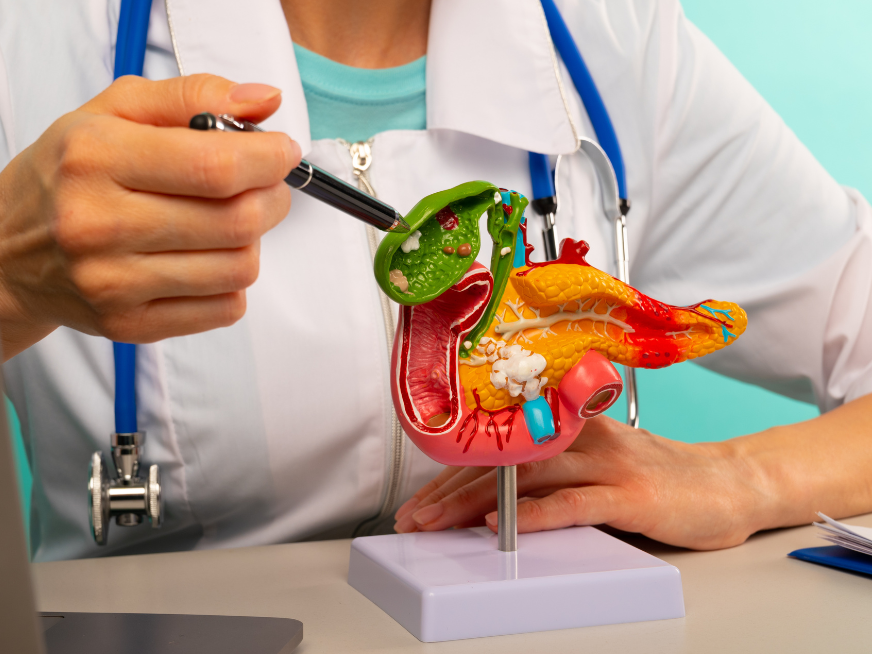 Tratamiento ambulatorio por cálculos en la vesícula