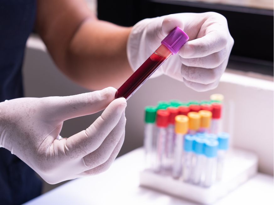 Leucemia: ¿Qué tipos de leucemia existen? ¿Cómo se tratan?