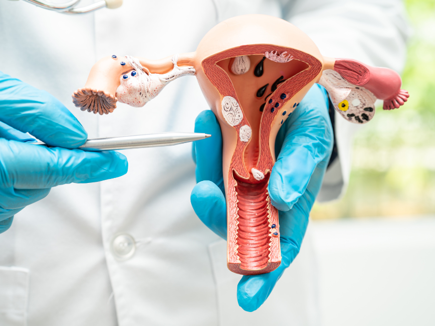 Marzo mes de concientización sobre el Cáncer de Cuello Uterino