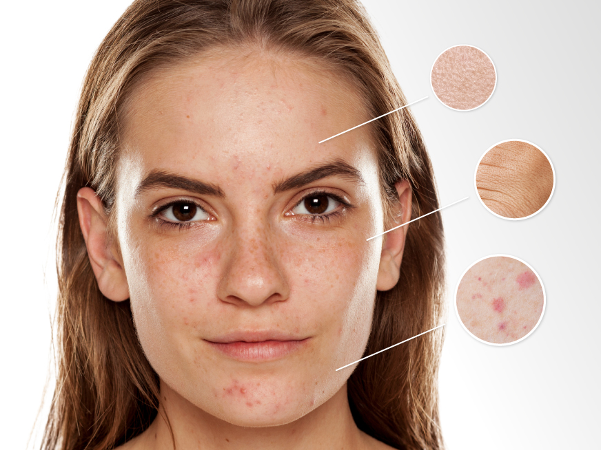 Microbioma, exposoma y genoma: nueva perspectiva en el cuidado de la piel