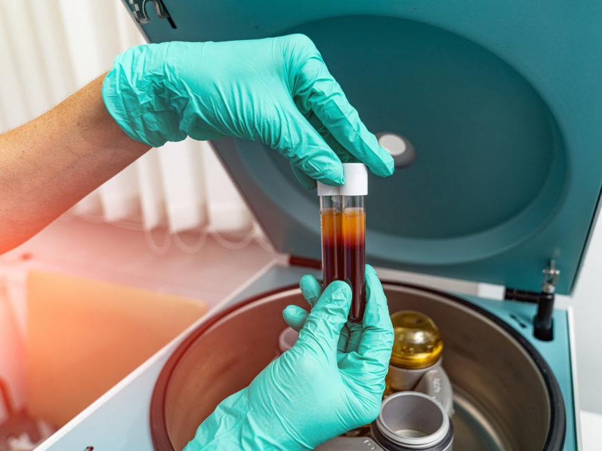 El poder de tu propio cuerpo: cómo las terapias biológicas regenerativas mejoran la calidad de vida