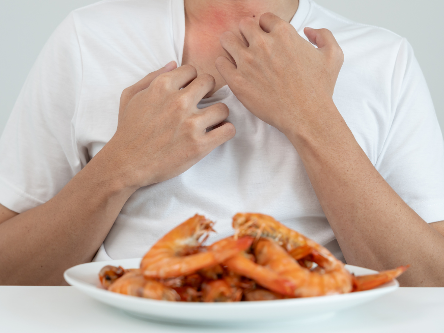 Semana de alergias alimentarias: manifestaciones, diagnóstico y tratamiento