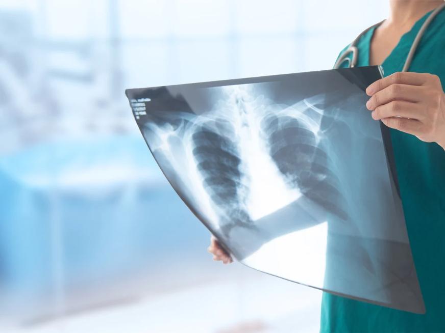 Fellowship en Diagnóstico por Imágenes Cardiovasculares