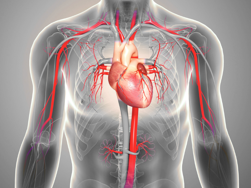 ABC SCITE: aprendizaje basado en casos ¿Hay lugar para el tratamiento endovascular en el TEP de alto riesgo?