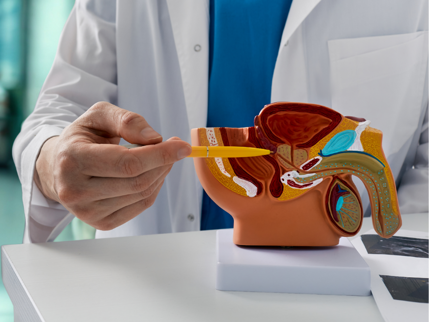 Cáncer de próstata: ¿por qué los controles tempranos pueden salvar vidas?