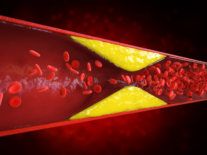 Colesterol y jóvenes: ¿una bomba que podemos desactivar?